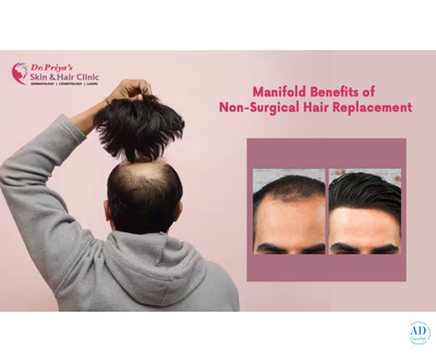 Discover the Best Non-Surgical Hair Replacement Solutions for Natural Results