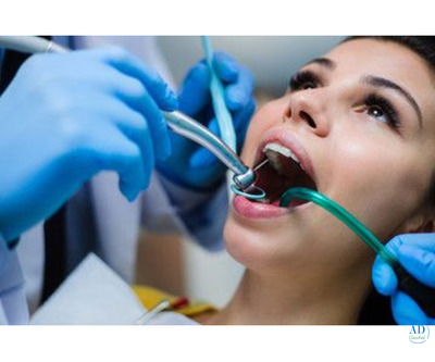 Endodontists In Doha