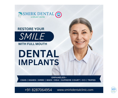 Best Dental Implant Clinic in Delhi