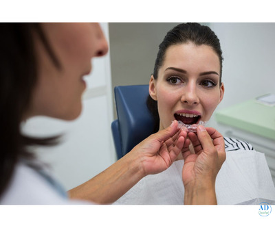 Discreet Orthodontic Solutions for Adults – Visit The Smile Spa