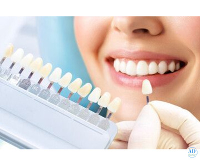 Expert Dental Implant Center in Doha
