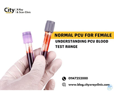 Normal PCV for Female – Understanding PCV Blood Test Range
