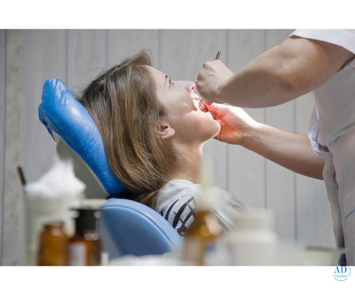 Full Mouth Rehabilitation by Expert Dentist in Ahmedabad