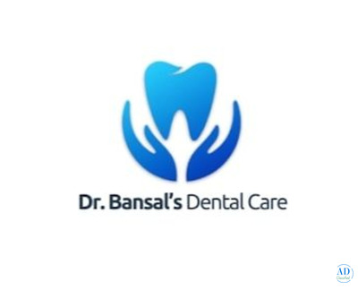 Dr. Bansal’s Dental Care - Dental Implant in Patiala