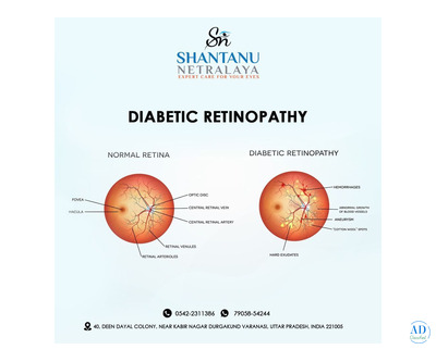 Expert Retina Care in Varanasi – Consult a Specialist Today