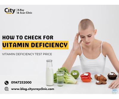 How to Check for Vitamin Deficiency – Vitamin Deficiency Test Price