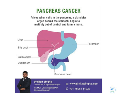 Pancreatic Cancer Treatment in Ahmedabad, India: Smart Approach