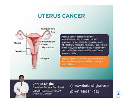 Robotic Uterus Cancer Surgery in Ahmedabad, India: Less Invasive