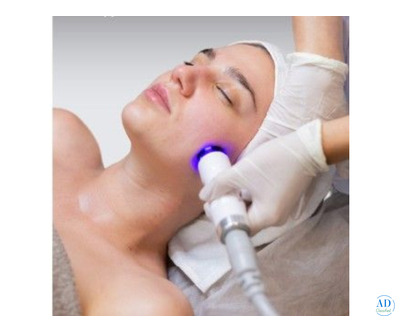 MNRF Treatment in Delhi – Advanced Skin Rejuvenation