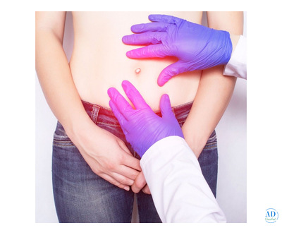Advanced Hernia Repair by the Best Hernia Surgeon in India
