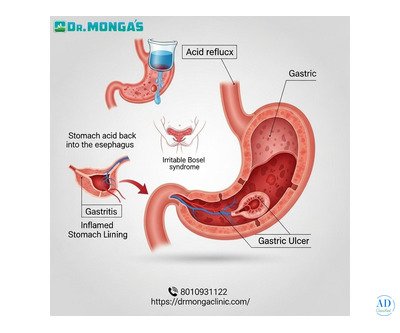 Lady doctor for stomach pain in Ghazipur