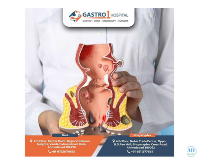 Get Treated by the Best Fissure Doctor in Ahmedabad – Gastro1 Hospital