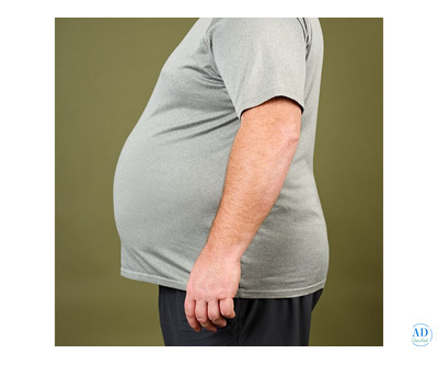Transform Your Health with Expert Obesity Surgery in India