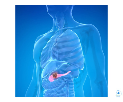 Advanced Pancreatic Care with Precision Surgery in India