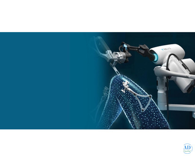Best Robotic Knee Replacement Surgery in Ahmedabad: robotic accuracy