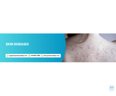 Ayurvedic Skin Disease Treatment in Bangalore – Praanavaidya