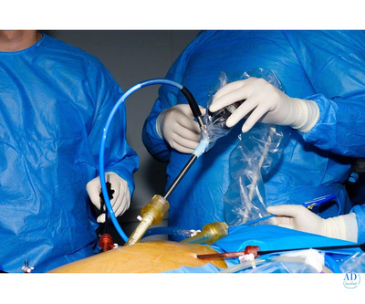 Advanced Laparoscopy Training