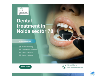Advanced Dental Care in Noida Sector 78