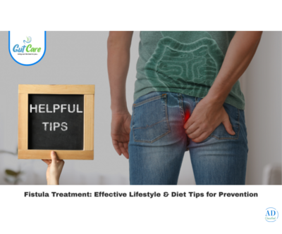 Trusted Fistula Treatment in Bangalore – Gut Care Clinics