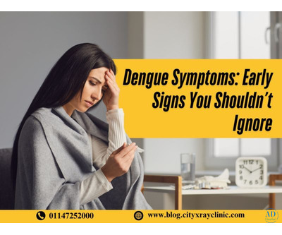 Dengue Symptoms & Effective Treatment Options