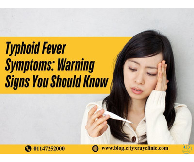 Typhoid Fever: Symptoms & Main Causes Explained