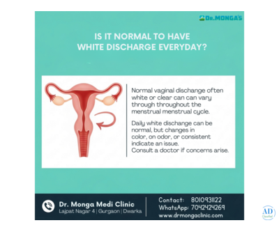 Is It Possible to Stop White Discharge Naturally? Find Out How