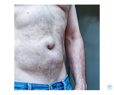 Best Hernia Surgeon in Ahmedabad: Safe & Effective Surgery