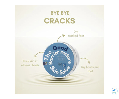 Moisturiser Cream for Sensitive Skin – Gentle & Hydrating