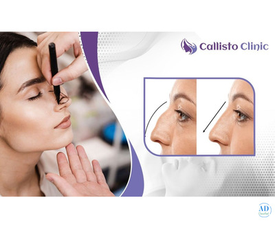 Rhinoplasty Solutions in Surat | CallistoClinic