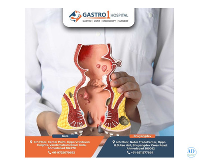 Expert Care for Fissures – Best Fissure Doctor in Ahmedabad
