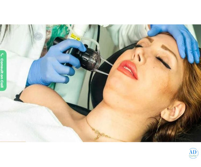 Build your natural beauty with non-surgical thread lift treatment in Bangalore!