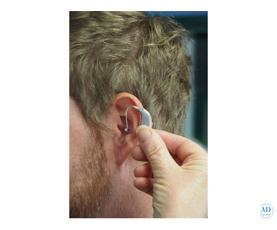 Hearing Aid Brands Faridabad | Widex, PHONAK, Signia & More
