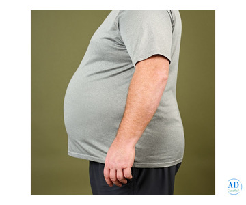Best Obesity Surgeon in Ahmedabad for Lasting Results