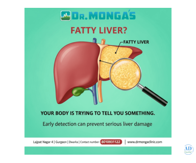 Ayurvedic Treatment for Fatty Liver