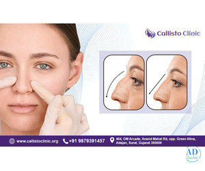 Rhinoplasty in Surat - Nose Reshaping by Callistoclinic