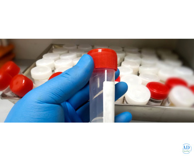 Top Semen Analysis Test Centre in Bangalore
