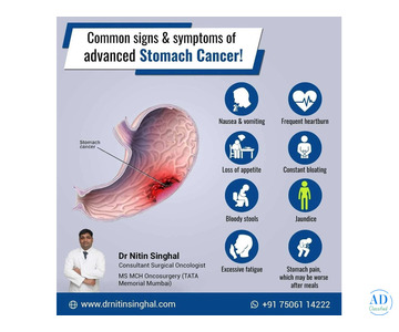 Advanced Stomach Cancer Surgeon In Ahmedabad: Dr. Nitin Singhal