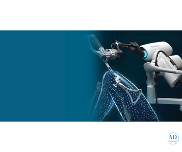 Advanced Robotic Knee Replacement Surgery in Ahmedabad – Precision & Faster Healing