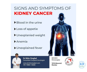Kidney Cancer Surgeon in Ahmedabad: Faster Recovery