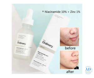 The Ordinary Niacinamide Serum in Pakistan - 03011594111