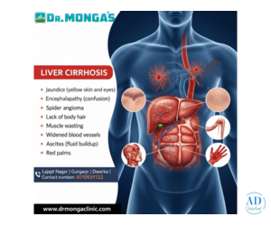 Best Liver Cirrhosis Treatment Hospital in India