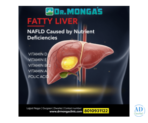 What is grade 1 fatty liver