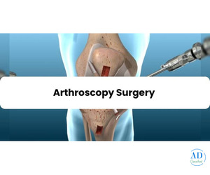 Arthroscopy Surgery in Punjab | Elite Orthopaedics