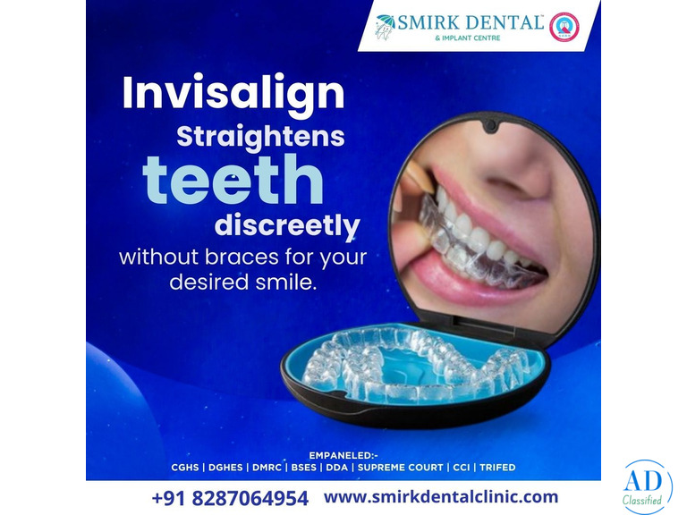 Best Root Canal Treatment in Delhi