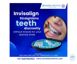 Best Root Canal Treatment in Delhi Best Root Canal Treatment in Delhi