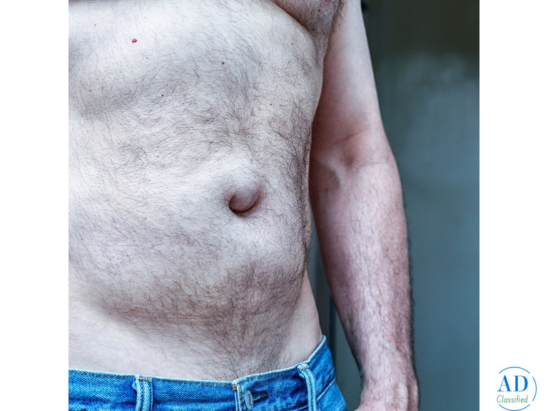 Best Hernia Surgeon in India: Expert Surgical Solutions