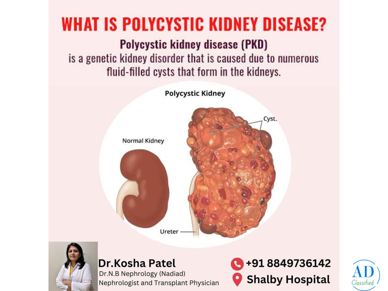 Specialized Treatment from the Best Nephrologist in Ahmedabad