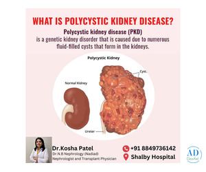 Specialized Treatment from the Best Nephrologist in Ahmedabad