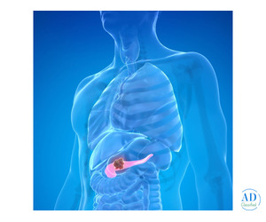 Best Pancreatic Surgeon in India: Expert Care, Better Outcomes