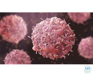 Best Doctor for Precision Oncology in Gurgaon